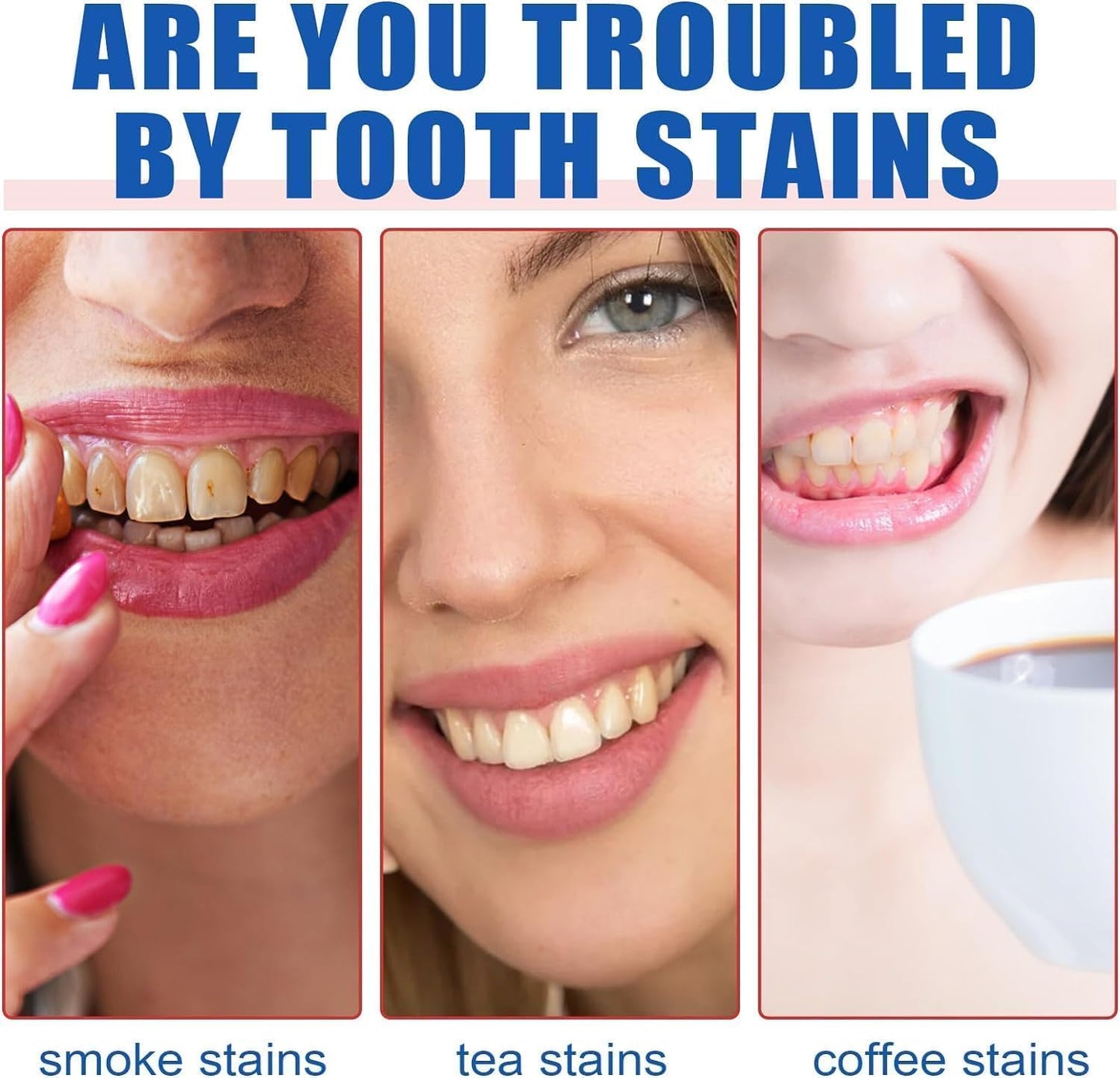 SP-4 Teeth Whitening Pen – Instantly Remove Stains & Brighten Your Smile
